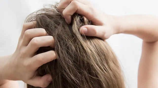 Kebiasaan Sehari-hari yang Dapat Menyebabkan Kerontokan Rambut di Usia Muda, Stop Sekarang Juga