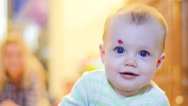 [Bintang] Tanda Lahir