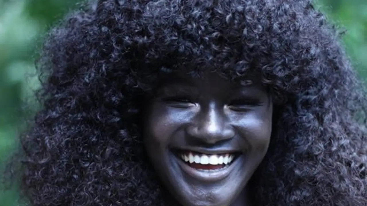 7 Orang Ini Terkenal Karena Warna Kulit Memukau