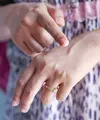 Kulit kering dan dehidrasi sama-sama dapat membuat wajah terasa tidak nyaman. Kenali perbedaan keduanya agar perawatan yang dilakukan lebih sesuai dengan kebutuhan kulit. (Foto/Dok: Pexels)