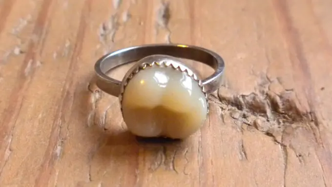 Cowok Ini Berikan Gigi Bungsu Sebagai Cincin Lamaran ke Pacarnya