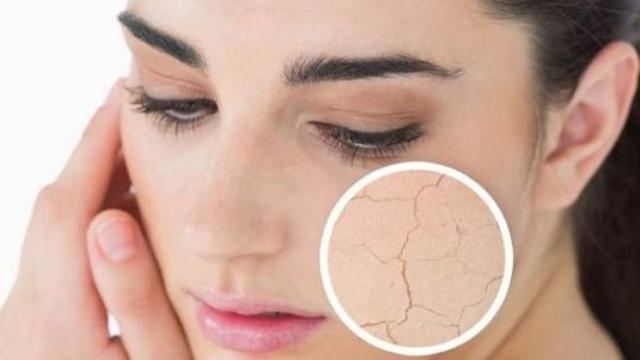 Cara Mudah Hidrasi Wajah Tanpa Membuatnya Bersisik