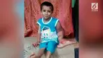 Tajbir Akhtar, anak di Bangladesh yang memiliki ukuran tangan kiri lebih besar dari tangan kanannya.