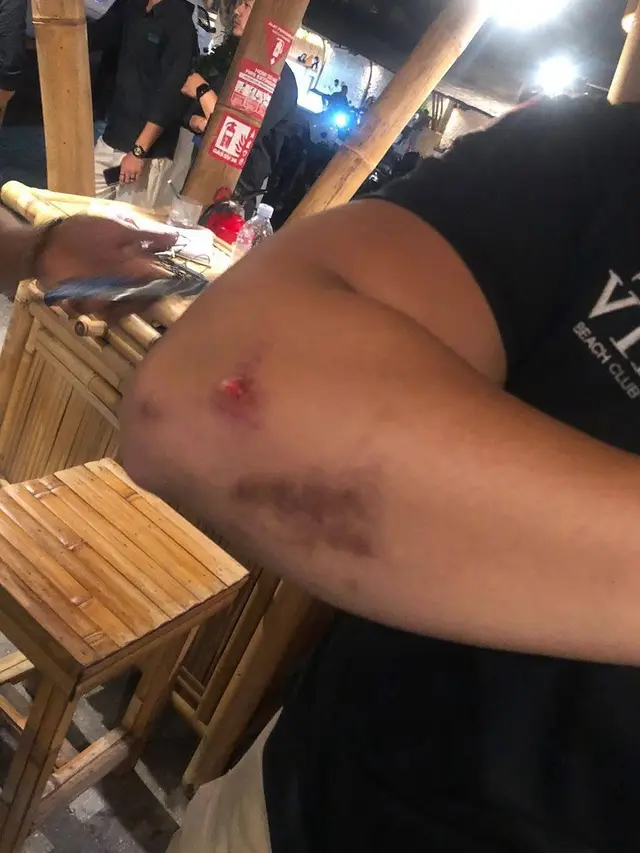 4 Turis Asing Keroyok Sekuriti Finns Beach Club di Bali, Dipicu Keributan di dalam Kelab