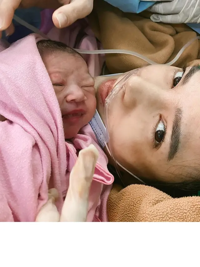 Pendarahan 3 Liter, Ini 6 Potret Perjuangan Alice Norin Melahirkan Anak Kedua