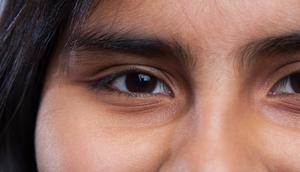 Ilustrasi kantung mata (copyright Freepik)