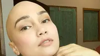 Feby Febiola Ditelepon Mantan Suami Terkait Kanker, Percakapannya Bikin Terenyuh
