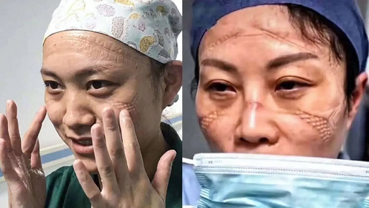 4 Kisah Perjuangan Dokter dan Perawat di Wuhan Rawat Pasien Virus Corona, Bikin Haru