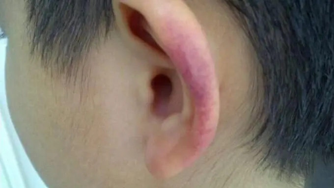 Lagi, Beredar Video Kekerasan pada Murid oleh Guru di Medan