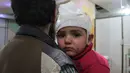 Ekspresi seorang anak yang terluka akibat serangan udara pasukan Assad di wilayah Ghouta timur, Suriah (7/2). (AFP Photo/Hamza Al-Ajweh)