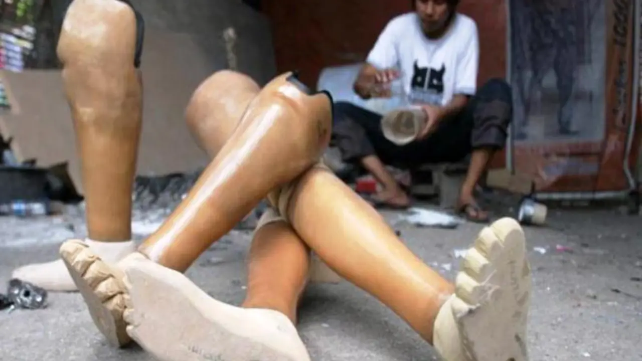 Intip Betapa Mulianya Bengkel Kaki Palsu di Jawa Timur Ini