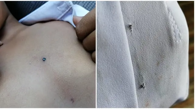 Bocah Ini Jadi Korban Bully Sampai Ditusuk Dengan Pensil, Kisahnya Viral