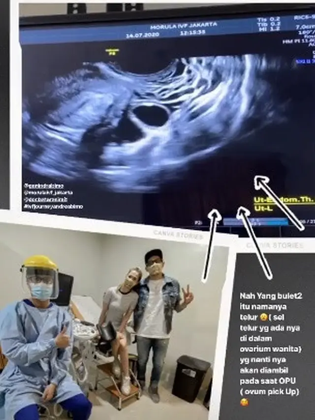 Idamkan Buah Hati, Ini 7 Momen Andrea Dian Jalani Program Bayi Tabung