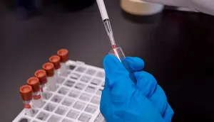 Indonesia Bangun Ekosistem Plasma Pertama, Apa Dampaknya bagi Kesehatan?