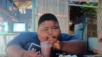 Satia Putra, bocah berusia 7 tahun asal Karawang, Jawa barat, memiliki berat badan mencapai 97 kilogram di usianya yang baru 7 tahun. (Liputan6.com/ Abramena)