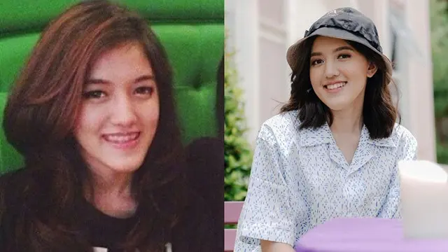 Beda Penampilan 5 Personel Blink Dulu Vs Kini, Ada yang Mantap Berhijab