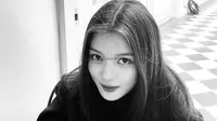 Tersiksanya Kim Yoo Jung Dipaksa Diet Sejak Kecil, Kini Tak Bisa Makan Banyak
