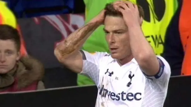 Hotspur Ditahan Imbang Basel
