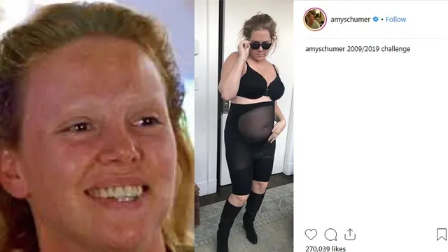 Amy Schumer