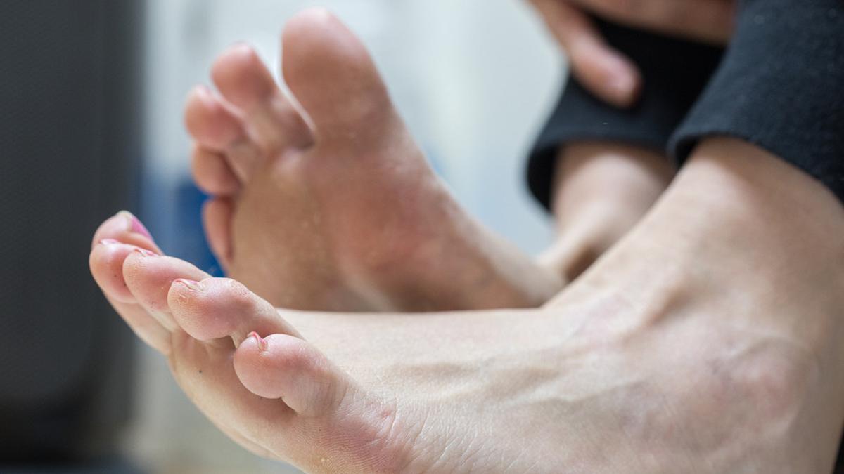 Arti Mimpi Kaki Patah Pertanda Akan Mendapat Pertolongan