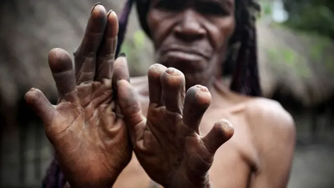 Tradisi Potong Jari dan Mandi Lumpur di Lembah Baliem, Papua