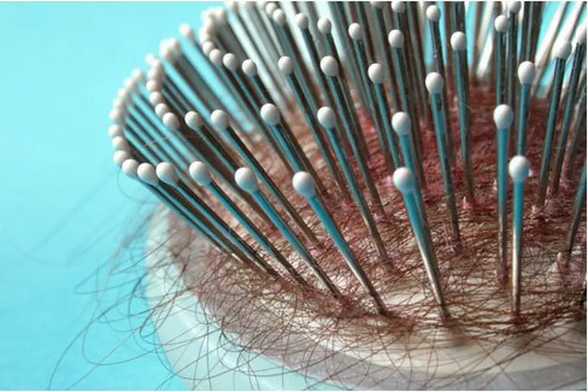 Rambut rontok/copyright Shutterstock.com