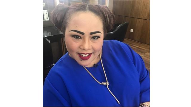 Rambut Mulai Rontok Pasca Kemoterapi, Ini 6 Potret Nunung Pakai Turban dan Wig