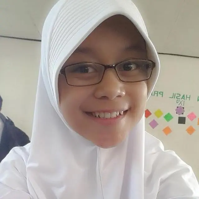 6 Foto Masa Remaja Lesty Kejora saat Pakai Kacamata Ini Bikin Pangling