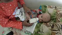 Dikasih Susu untuk Orang Dewasa, Kondisi 2 Balita Ini Mengenaskan