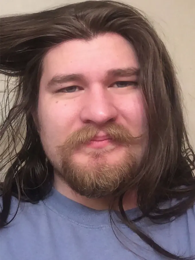 [Bintang] Dulunya Gemuk Banget, Sekarang Penampilan Pria Ini Mengejutkan Banyak Orang, Mirip Pangeran Disney