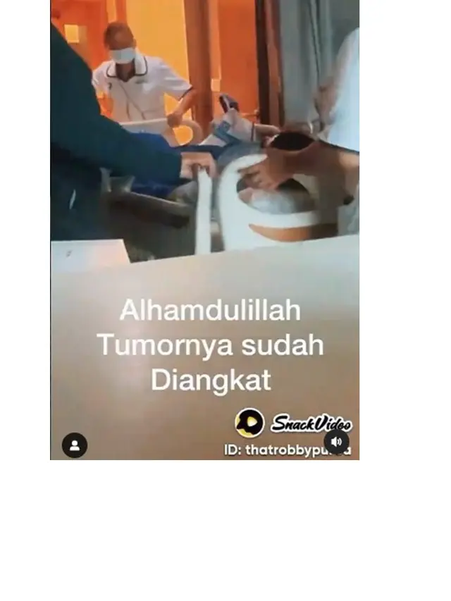 10 Potret Robby Purba Jalani Operasi Tumor Payudara, Jarang Terjadi pada Pria