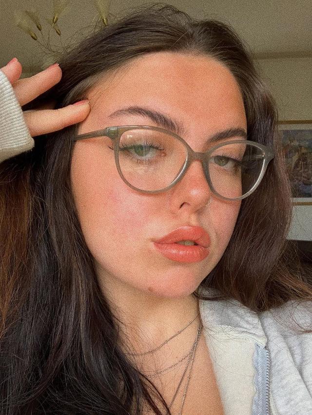 5 Potret Lorun Elisabeth, Wanita yang Viral Mirip Michael Jackson