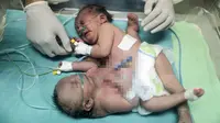 Bayi kembar siam asal Palestina berusia satu hari terlihat di dalam inkubator di Rumah Sakit al-Shifa di Kota Gaza, (22/10). Bayi kembar siam tersebut berjenis kelamin perempuan. (AFP Photo/Mahmud Hams)