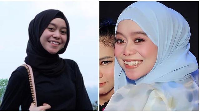 6 Beda Gaya Lesty Kejora Sebelum Vs Sesudah Pakai Behel Hilangkan Gingsul Hot Liputan6 Com