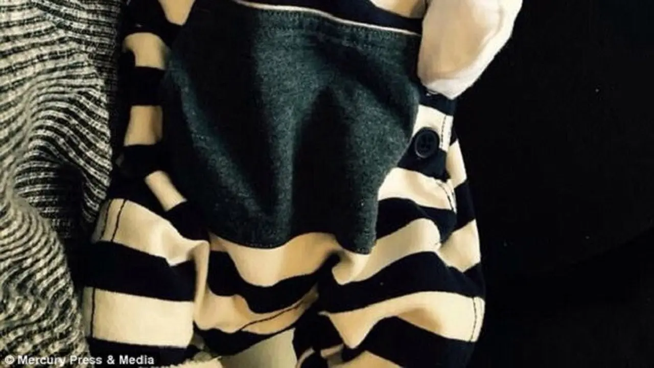 Bayi Alfie yang memiliki raut wajah pemarah. (Sumber Foto: Dailymail)
