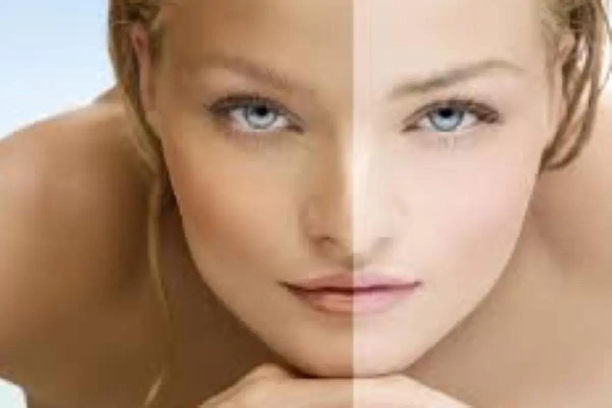 skin tone