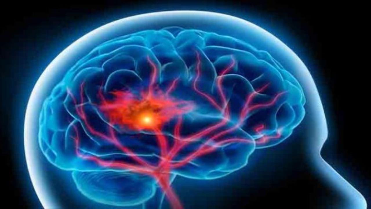 6 Hal Ini Bermanfaat untuk Mempertajam Memori