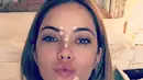 Ashley Benson memamerkan wajahnya yang tengah dalam perawatan jerawat lewat akun Instagram. (instagram/HollywoodLife)