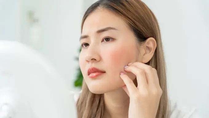 How To: Menenangkan Kulit Wajah Kemerahan Menurut Anjuran Ahli Dermatologi, Ternyata Praktis Kok!