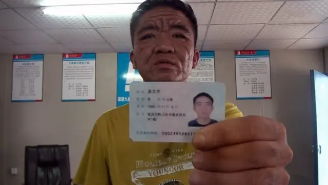Penyakit Misterius Ubah Pemuda 30 Tahun jadi Kakek 80 Tahun