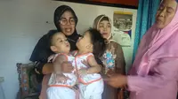 Bayi kembar siam Kendari, Aqila Dewi Sabila dan Azila Dewi Sabrina.(Liputan6.com/Ahmad Akbar Fua)