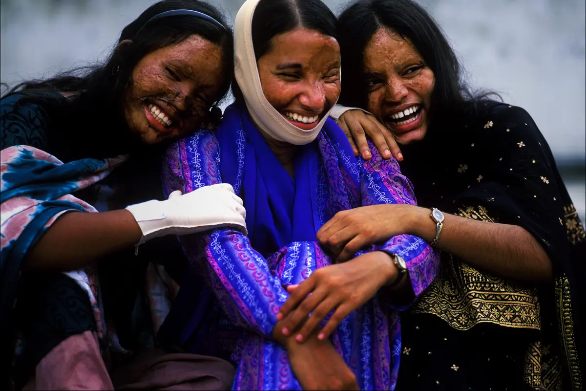 Disiram Air Keras, Wanita Asal Bangladesh Curi Perhatian Dunia
