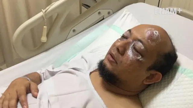 Penyidik senior KPK, Novel Baswedan disiram air keras saat pulang dari salat Subuh di Masjid Al Ikhasan Pegangsaan Dua, Kelapa Gading, Jakarta Utara, 11 April 2017. Akibat penyerangan itu, Novel dirawat di rumah sakit di kawasan Kelapa Gading. Polres ...