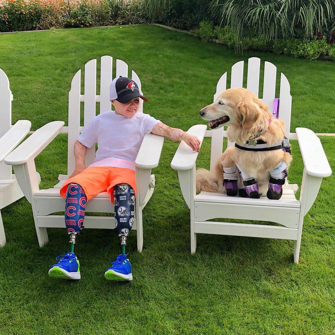 Owen akhirnya bertemu anjing bernama Chi Chi, yang kakinya juga diamputasi. (Courtesy Chi Chi Rescue Dog)