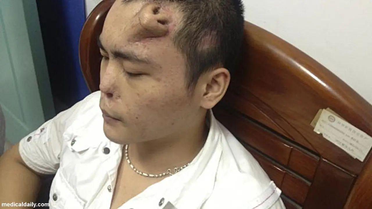 hidung-dijidat-130926b.jpg
