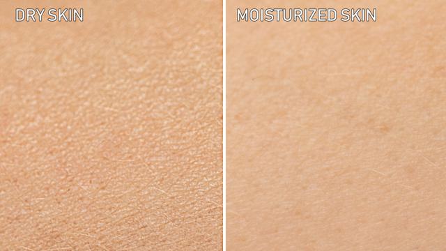 Ilustrasi kulit kering