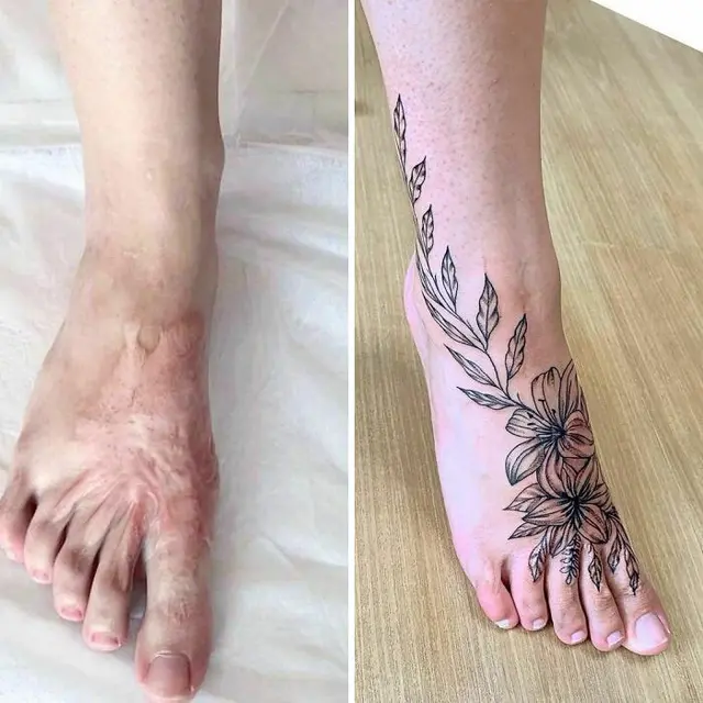 Gunakan Tato Untuk Menutupi Bekas Luka, 6 Potret Hasilnya Bikin Takjub. (Sumber: Boredpanda)