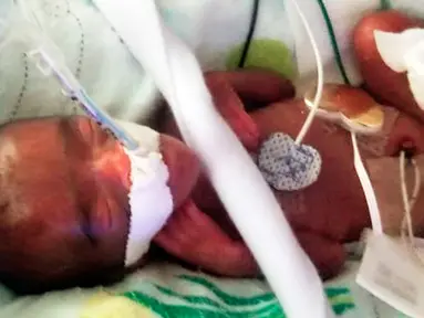 Foto pada Desember 2018 memperlihatkan seorang bayi yang dipanggil dengan nama Saybie. Bayi perempuan itu lahir dengan berat 245 gram di Rumah Sakit Ibu dan Anak Sharp Mary Birch, kata rumah sakit itu saat mengumumkan kelahiran dan kepulangan Saybie pada Rabu (29/5). (Sharp HealthCare via AP)