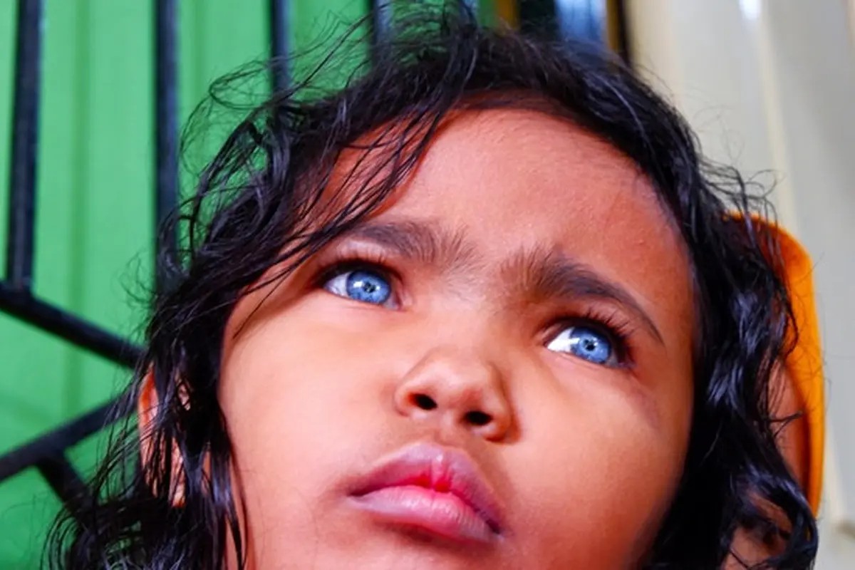 Anak bermata biru di Pekanbaru, Dzakira Azizy Naqiya.