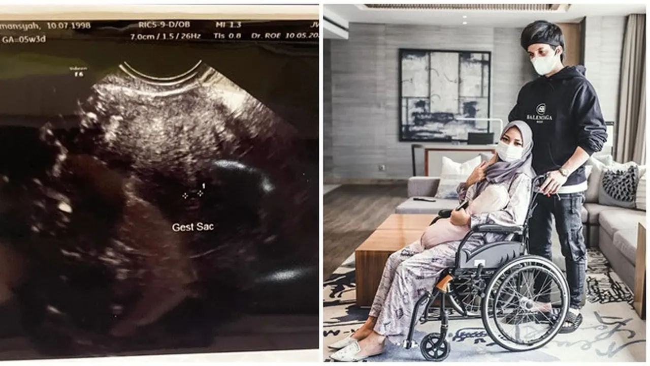 Aurel Keguguran, Ini 6 Momen Atta Halilintar Setia Dampingi Istri Selama Hamil